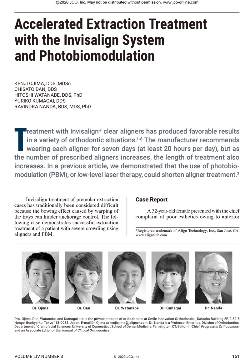 Accelerated Extraction Treatment with the Invisalign System and Photobiomodulation