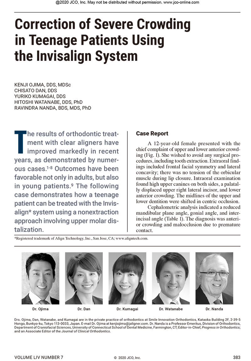 Correction of Severe Crowding in Teenage Patients Using the Invisalign System