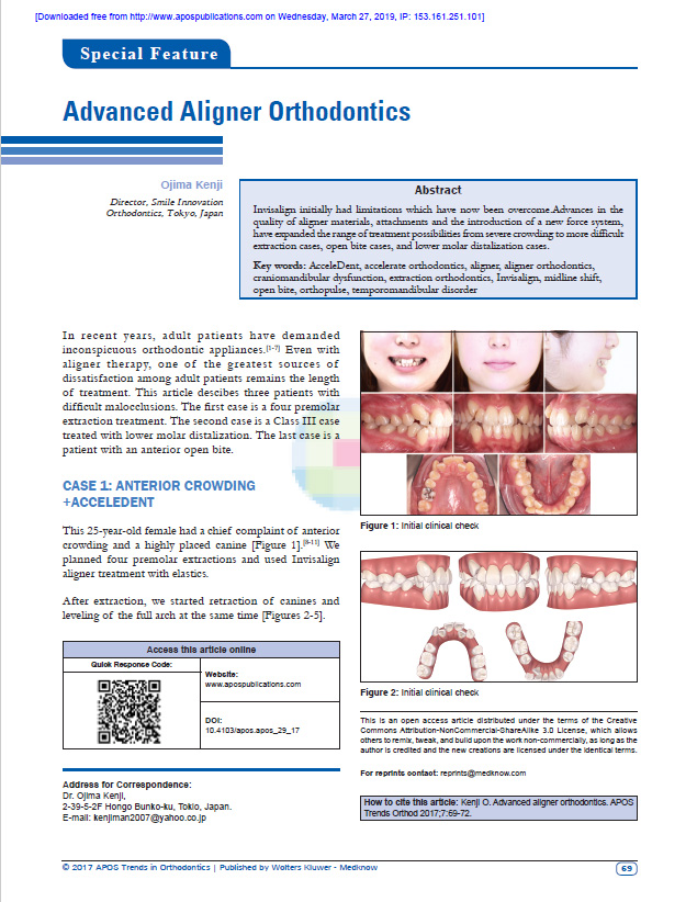 Advanced Aligner Orthodontics