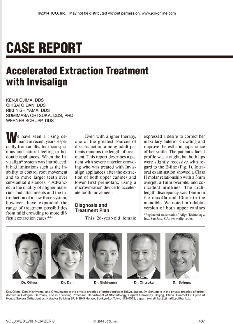 CASE REPORT Accelerated Extraction Treatment with Invisalign